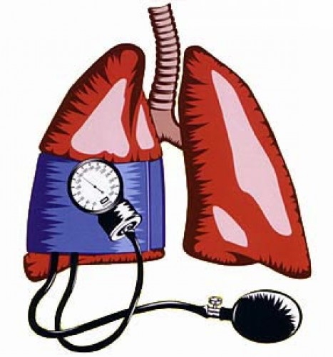 pulmonalis hypertonia