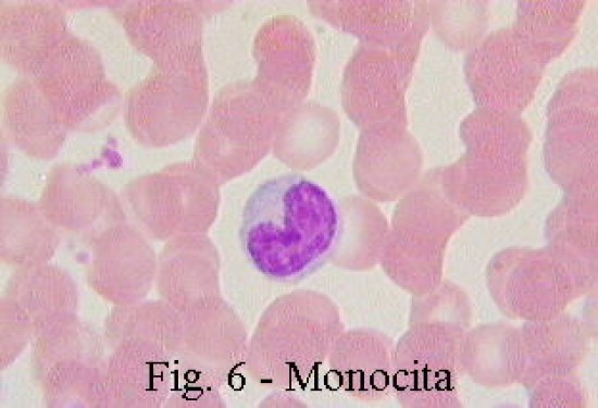 vérkép monocita