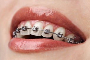  Amíg vannak fogai, szabályozhatja azokat