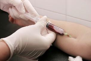  HIV teszt: Miért szükséges ez?