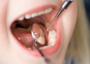 A fluorid hátráltatja a fogszuvasodást