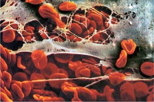 A véralvadás felelősei: Vérlemezkék