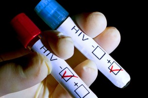 Ártatlannak tűnő influenzaszerű tünetek - a HIV-fertőzés első jelei