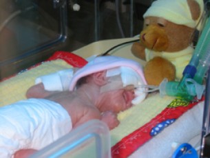 Életmentő szívműtét csecsemőkorban: Életkilátások nagyér transzpozíci