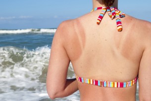 Foltoktól a ráncokig: Így teszi tönkre a bőrt a napfény
