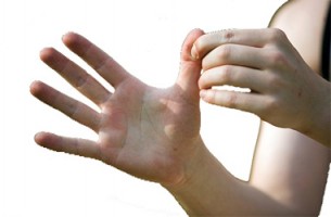 Gyanús tünet - így jelentkezik az ujjbegy-ekcéma