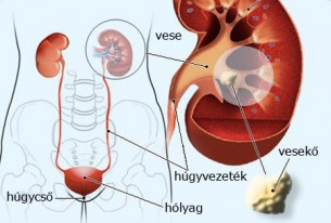 A prostatitisből fáj a vese. Krónikus prosztatagyulladás | Urológiai Klinika