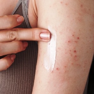 Tévhit: A bőr nem válik rezisztenssé a gyógyszerekre