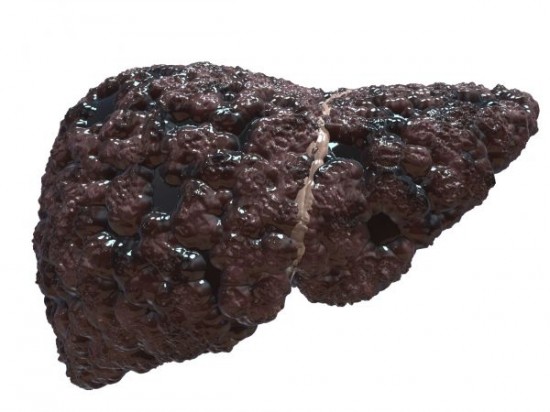 A májrák kávéval is megelőzhető?