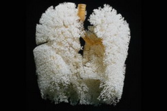 Az akut tüdőkárosodás is kezelhetővé válhat