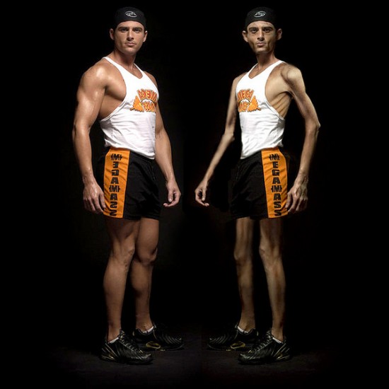 Fiúknál sem ritka az evészavar