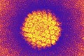 Gátolhatja a HPV a méhnyakrákot?