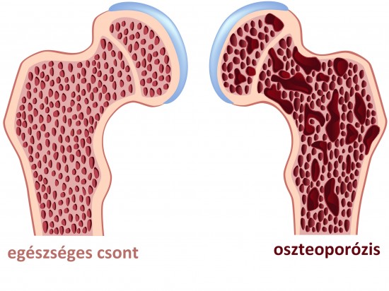 fájdalomcsillapítás térdízületek ízületi gyulladása esetén artrózis kezelő orvos