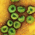 Kiderült az új vírusról: levegőben terjed
