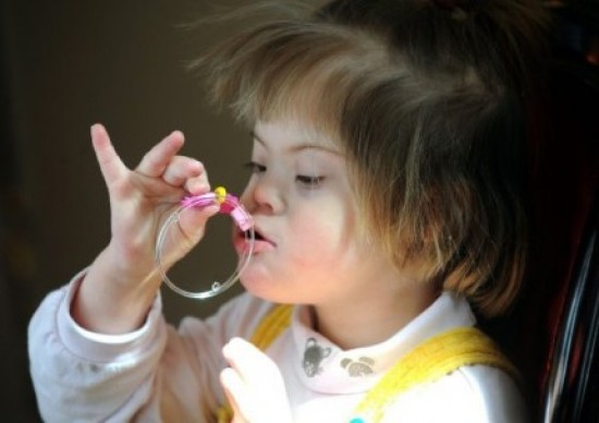 Támogasd a Down szindrómás gyerekeket!