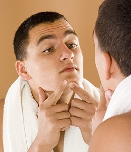 Tippek az akne kezelésére fiúknak