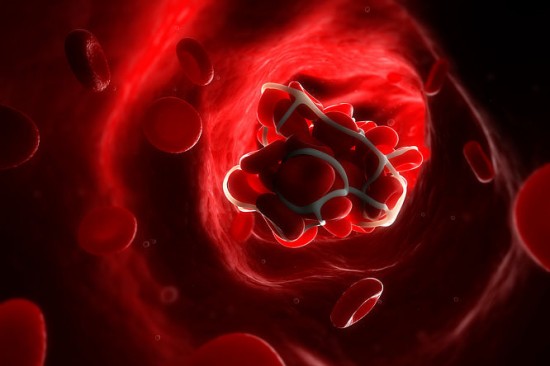 Visszaütött az emberre egy régi mutáció