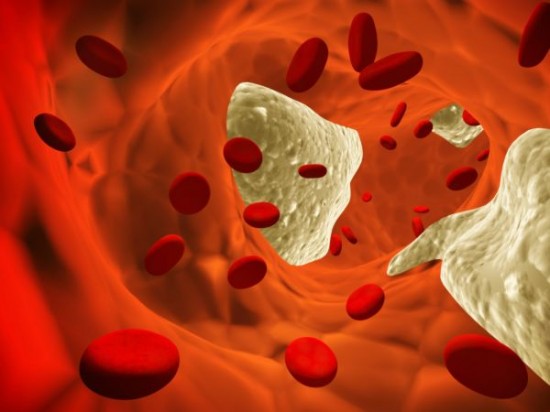 Szív- és érrendszeri megbetegedések - Visszérbetegségek - Trombózis