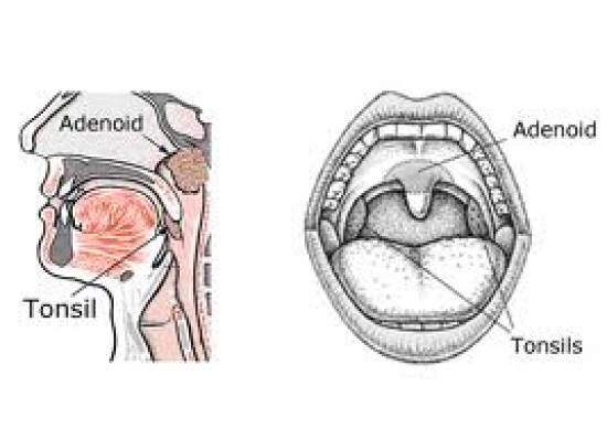 Adenoidok