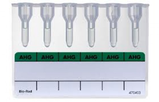 Antiglobulinteszt - Coombs-teszt