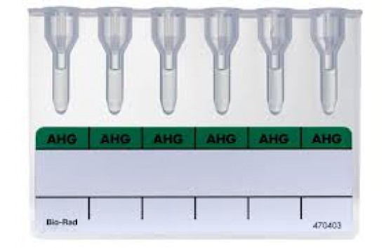 Antiglobulinteszt - Coombs-teszt