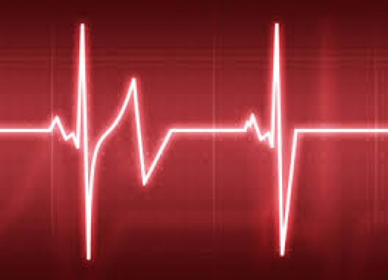 Aritmia - szívritmuszavar, irreguláris szívműködés