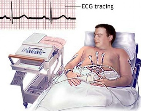 EKG - Elektrokardiogram