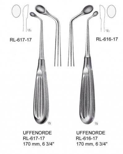 Endocervicalis küret