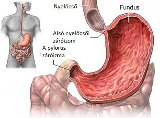 Gasztrikus