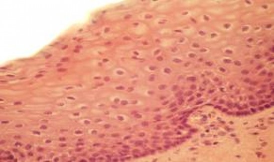 Laphámsejt - squamous epithelium