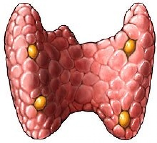 Parathyreoidea adenoma