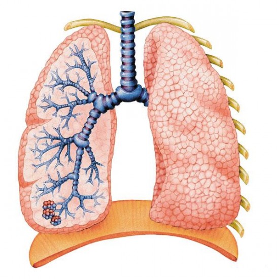 Pneumonektómia - pulmonectomia