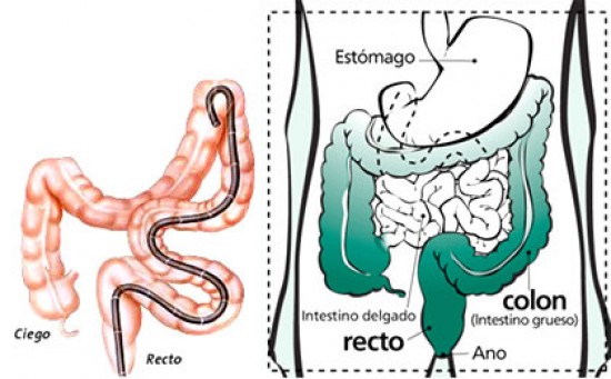 Proctosigmoidoscopia