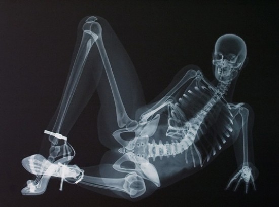 Röntgensugár