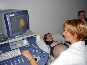  Abortusz szívhibák miatt