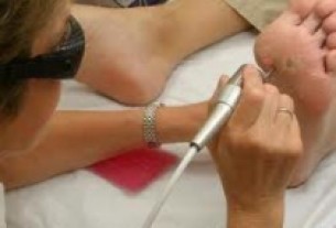  Égető probléma: Így kezeld a szemölcsöt