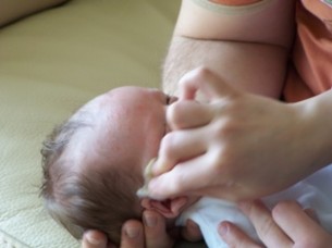  Ha összeragad a baba szeme