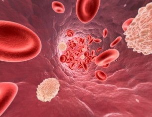  Hiperkoleszterinémia tünetei