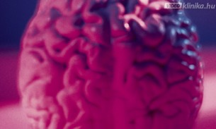  Ilyenkor jelez bajt az agyi érmalformáció