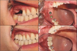  Rendezett fogazat - fontosabb, mint gondolnád!