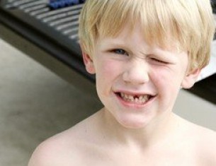  Rendhagyó fogpanaszok - amikor a tisztítás többet árt, mint használ