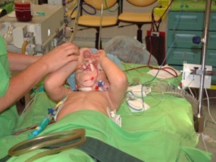 A gyermekkori szívbillentyű elváltozás egész életünkben elkísér