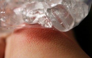 A jegelés szabályai - ha nem tartod be a bőröd látja kárát