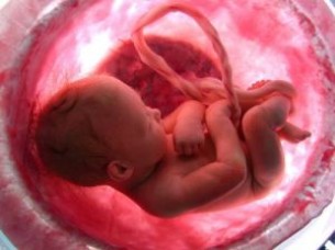 A magzati szívritmuszavar kezelése