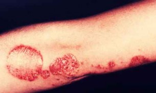 A szavak ereje - betegen fontosabb, mint gondolnád