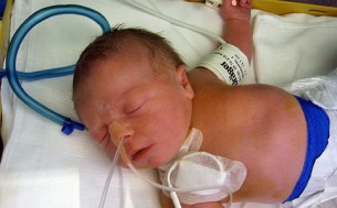 Bal szívfél fejlődési rendellenességének kezelése