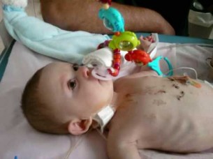 Fallot-tetralógia diagnózisa, kezelése