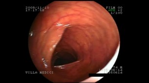 Félelem és rettegés a gasztroenterológusnál: Tényleg kell a pszichológus?
