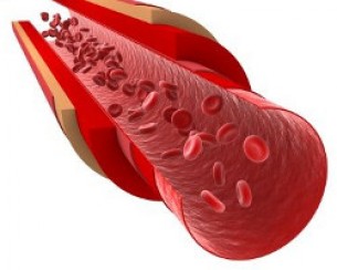 Füstbe ment artériák: Ezt jelenti a kirakatbetegség!