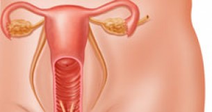 Kezelhetetlen hüvelyfolyás - az alapos kivizsgálás elengedhetetlen